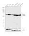 Aldehyde Dehydrogenase 2 Family Member antibody, MA5-17029, Invitrogen Antibodies, Western Blot image 