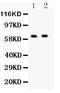 Hexosaminidase Subunit Beta antibody, LS-C344061, Lifespan Biosciences, Western Blot image 
