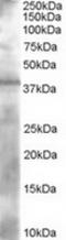 Alcohol Dehydrogenase 1A (Class I), Alpha Polypeptide antibody, TA302985, Origene, Western Blot image 