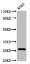 CD81 Molecule antibody, CSB-RA004960A0HU, Cusabio, Western Blot image 