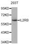 Interleukin 2 Receptor Subunit Beta antibody, LS-C346105, Lifespan Biosciences, Western Blot image 