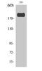 Insulin Receptor Substrate 1 antibody, A00268S307-1, Boster Biological Technology, Western Blot image 