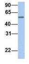 EPS8 Like 1 antibody, GTX47008, GeneTex, Western Blot image 