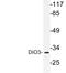 Iodothyronine Deiodinase 3 antibody, LS-C199830, Lifespan Biosciences, Western Blot image 