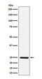 Ephrin A1 antibody, M04656, Boster Biological Technology, Western Blot image 