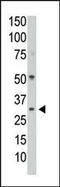 Protein Phosphatase 1 Catalytic Subunit Gamma antibody, PA5-15533, Invitrogen Antibodies, Western Blot image 