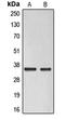 ELOVL Fatty Acid Elongase 6 antibody, LS-C353546, Lifespan Biosciences, Western Blot image 