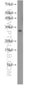 Small Cell Adhesion Glycoprotein antibody, 14998-1-AP, Proteintech Group, Western Blot image 