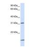 Solute Carrier Family 25 Member 11 antibody, NBP1-59596, Novus Biologicals, Western Blot image 
