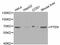 Phosphatase And Tensin Homolog antibody, STJ29771, St John