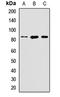 Solute Carrier Family 39 Member 6 antibody, LS-C668175, Lifespan Biosciences, Western Blot image 