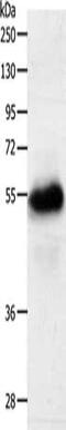 Solute Carrier Family 22 Member 6 antibody, CSB-PA163258, Cusabio, Western Blot image 