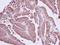 Coronin 2A antibody, NBP2-15966, Novus Biologicals, Immunohistochemistry paraffin image 