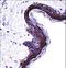 Proteasome Subunit Beta 5 antibody, LS-C162231, Lifespan Biosciences, Immunohistochemistry paraffin image 