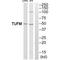 Tu Translation Elongation Factor, Mitochondrial antibody, A05606, Boster Biological Technology, Western Blot image 