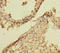 RAB27B, Member RAS Oncogene Family antibody, LS-C682135, Lifespan Biosciences, Immunohistochemistry paraffin image 