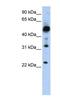 Transmembrane Protein 38B antibody, NBP1-59976, Novus Biologicals, Western Blot image 