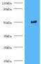 Trimethyllysine Hydroxylase, Epsilon antibody, MBS1488574, MyBioSource, Western Blot image 