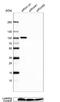 Non-SMC Condensin II Complex Subunit H2 antibody, NBP2-57498, Novus Biologicals, Western Blot image 