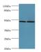 Adaptor Related Protein Complex 1 Subunit Mu 2 antibody, LS-C380285, Lifespan Biosciences, Western Blot image 