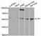 LYN Proto-Oncogene, Src Family Tyrosine Kinase antibody, STJ24435, St John