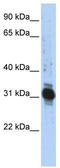 Zinc Finger AN1-Type Containing 3 antibody, TA335487, Origene, Western Blot image 