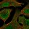 Cytochrome P450 Family 24 Subfamily A Member 1 antibody, PA5-66632, Invitrogen Antibodies, Immunofluorescence image 