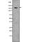 MutS Homolog 6 antibody, abx147106, Abbexa, Western Blot image 