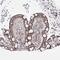 Homeobox C11 antibody, NBP1-83230, Novus Biologicals, Immunohistochemistry paraffin image 