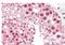 MutS protein homolog 5 antibody, AP31857PU-N, Origene, Immunohistochemistry paraffin image 
