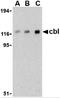 Cbl Proto-Oncogene antibody, 3967, ProSci, Western Blot image 