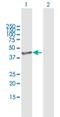 G Protein Subunit Alpha Q antibody, H00002776-B01P, Novus Biologicals, Western Blot image 