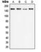 Phospholipase C Gamma 1 antibody, orb214404, Biorbyt, Western Blot image 