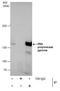 DNA Polymerase Gamma, Catalytic Subunit antibody, PA5-21314, Invitrogen Antibodies, Immunoprecipitation image 