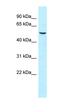 Sorting Nexin 8 antibody, orb331193, Biorbyt, Western Blot image 