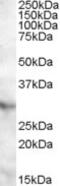 NAD(P)HX Epimerase antibody, MBS421813, MyBioSource, Western Blot image 