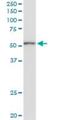 Potassium Calcium-Activated Channel Subfamily N Member 4 antibody, H00003783-D01P, Novus Biologicals, Western Blot image 