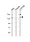 Ubiquitin Specific Peptidase 47 antibody, M07648, Boster Biological Technology, Western Blot image 