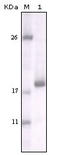 Discoidin Domain Receptor Tyrosine Kinase 2 antibody, STJ97997, St John