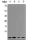 Cystatin A antibody, orb382603, Biorbyt, Western Blot image 