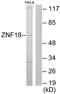 Zinc Finger Protein 18 antibody, GTX87111, GeneTex, Western Blot image 