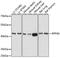 Ribonuclease P/MRP Subunit P40 antibody, 16-861, ProSci, Western Blot image 