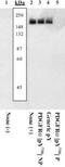 Platelet Derived Growth Factor Receptor Alpha antibody, ab5460, Abcam, Western Blot image 