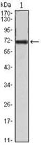 Protein Tyrosine Kinase 2 antibody, NBP1-47494, Novus Biologicals, Western Blot image 