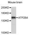 ATPase Plasma Membrane Ca2+ Transporting 4 antibody, abx136015, Abbexa, Western Blot image 