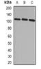 ADAM Metallopeptidase With Thrombospondin Type 1 Motif 5 antibody, abx225014, Abbexa, Western Blot image 