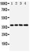 DNA repair protein XRCC3 antibody, PA1640, Boster Biological Technology, Western Blot image 