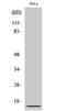 C-X-C Motif Chemokine Ligand 8 antibody, STJ93708, St John