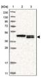 Thioredoxin Related Transmembrane Protein 4 antibody, PA5-51380, Invitrogen Antibodies, Western Blot image 