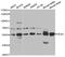 Hexosaminidase Subunit Alpha antibody, TA332812, Origene, Western Blot image 